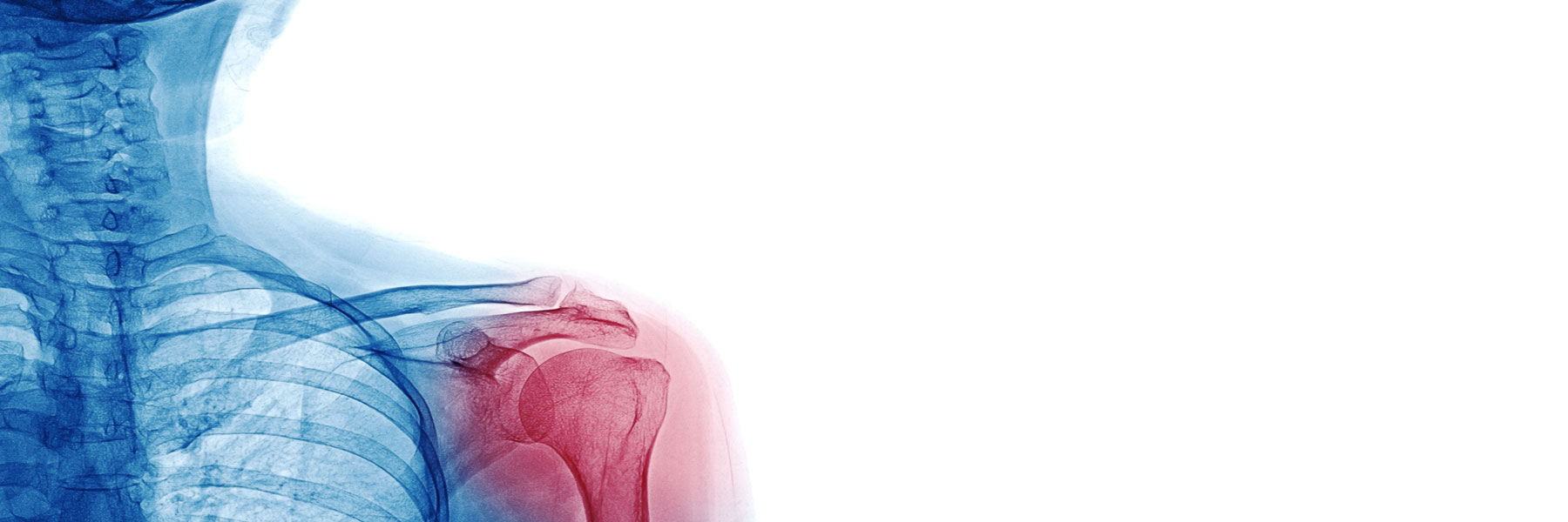 x-ray image of a person's shoulder